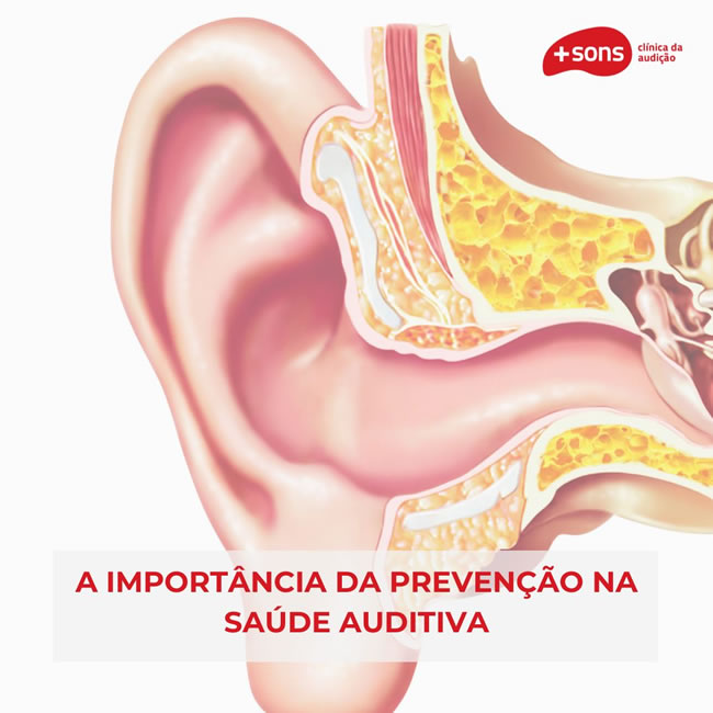 A Importância da Prevenção na Saúde Auditiva